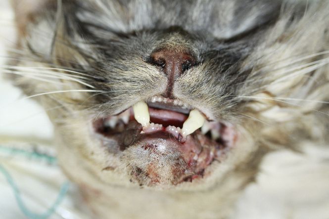 interdental bonding between her maxillary and mandibular canine teeth